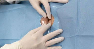 СОЛЭ-1 с одним отверстием