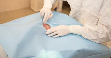 СОЛЭ-1 с одним отверстием